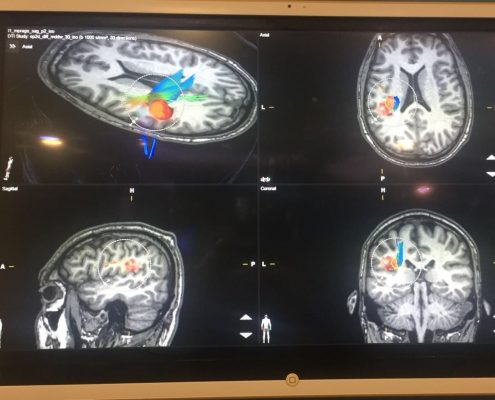 Neuropsicologo